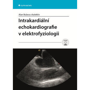 Intrakardiální echokardiografie v elektrofyziologii + DVD - Bulava Alan a kolektiv