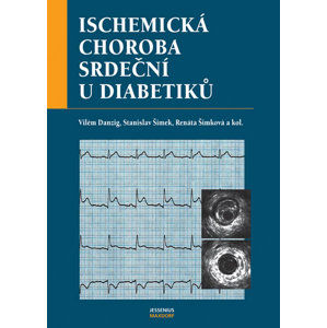 Ischemická choroba srdeční u diabetiků - Danzig Vilém a kolektiv
