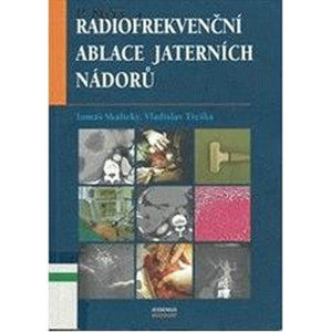 Radiofrekvenční ablace jaterních nádorů - Skalický Tomáš, Třeška Vladislav,