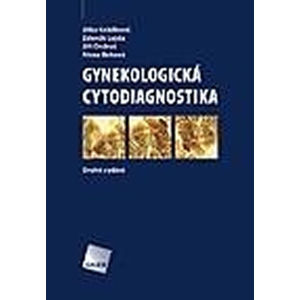 Gynekologická cytodiagnostika - Beková Alena