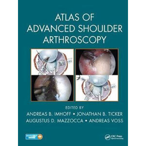 Atlas of Advanced Shoulder Arthroscopy - Imhoff Andreas B.