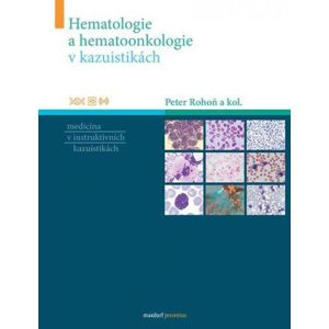 Hematologie a hematoonkologie v kazuistikách - Rohoň Peter