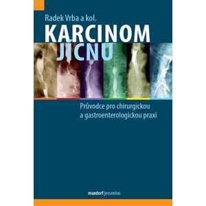 Karcinom jícnu - Průvodce pro chirurgickou a gastroenterologickou praxi - Vrba Radek