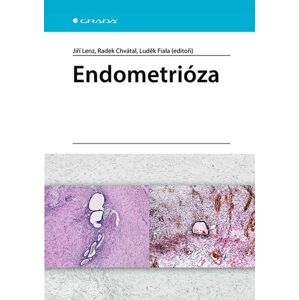 Endometrióza - Lenz Jiří a kolektiv