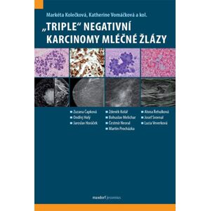 „Triple“ negativní karcinomy mléčné žlázy - Kolečková Markéta, Vomáčková Katherine,