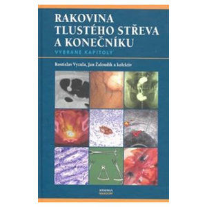 Rakovina tlustého střeva a konečníku - vybrané kapitoly - Vyzula Rostislav, Žaloudík Jan a kolektiv