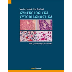 Gynekologická cytodiagnostika - Atlas cytohistologických korelací - Horáček Jaroslav, Kobilková Jitka