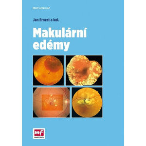 Makulární edémy - Ernest Jan a kolektiv